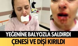 Yeğenine balyozla saldırdı!