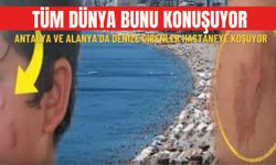 Tüm dünya bunu konuşuyor:  Antalya ve Alanya'da denize girenler hastaneye koşuyor