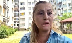 Antalya'da yaptırdığı estetik işlem hayatını mahvetti: Dudağı eridi