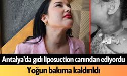 Antalya'da gıdı liposuction canından ediyordu! Yoğun bakıma kaldırıldı