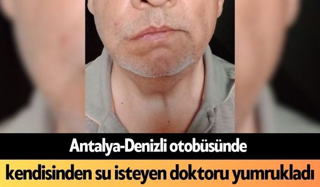 Antalya-Denizli otobüsünde kendisinden su isteyen doktoru yumrukladı