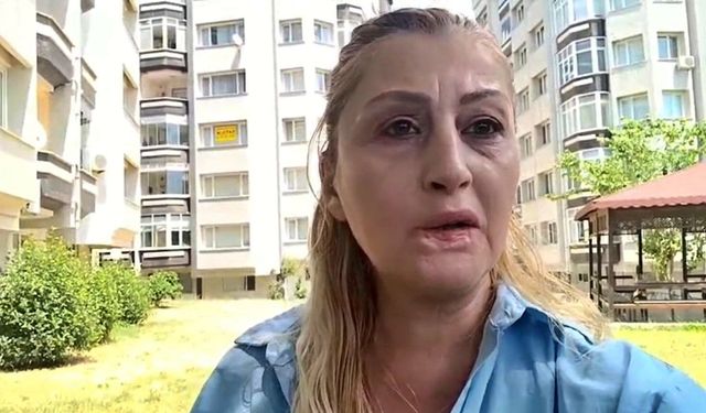 Antalya'da yaptırdığı estetik işlem hayatını mahvetti: Dudağı eridi