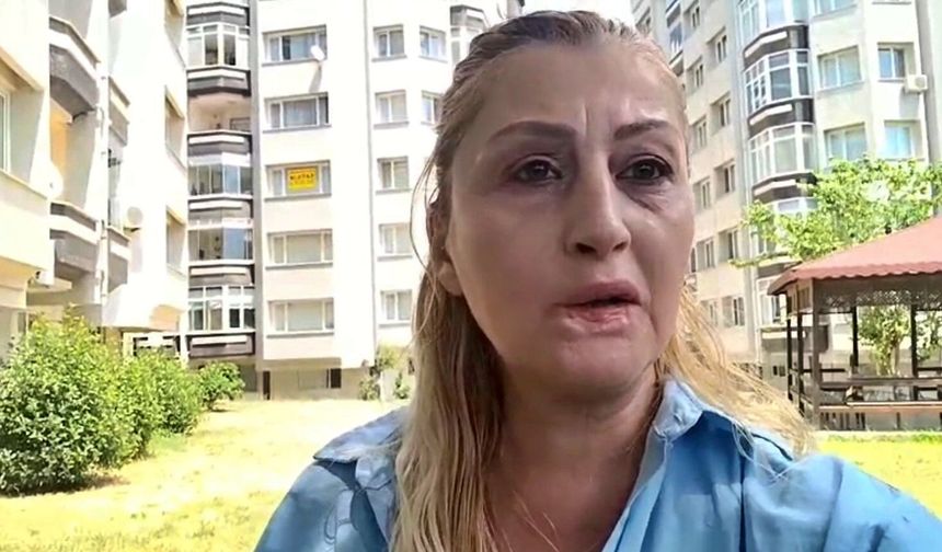 Antalya'da yaptırdığı estetik işlem hayatını mahvetti: Dudağı eridi