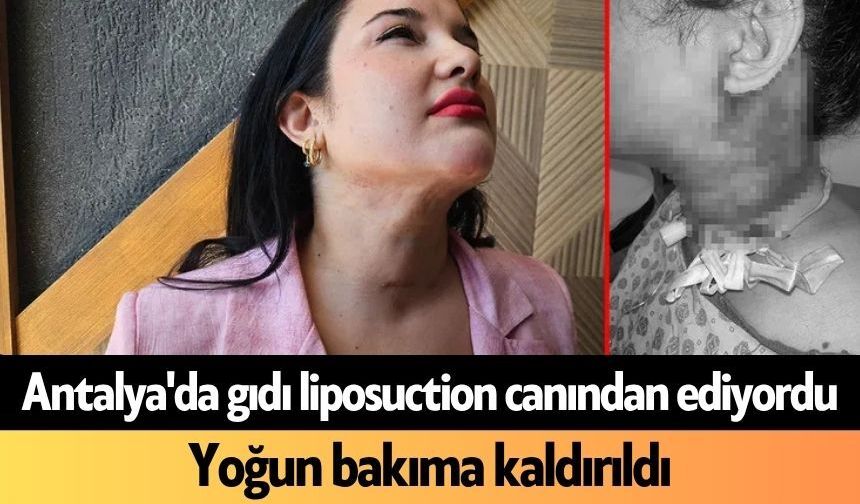 Antalya'da gıdı liposuction canından ediyordu! Yoğun bakıma kaldırıldı